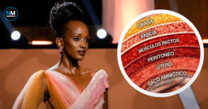 Trivia Elle Muhoza, Miss Uganda, luce The Layers of Life, vestido inspirado en las capas de una cesárea.